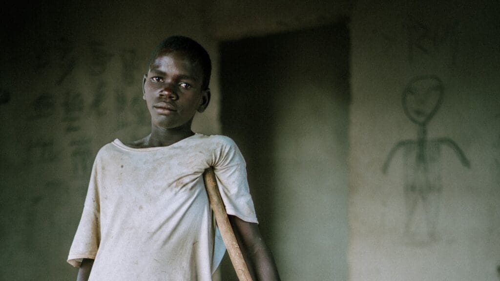 In Nigeria, persecution took Androwas' leg, yet he is grateful to God